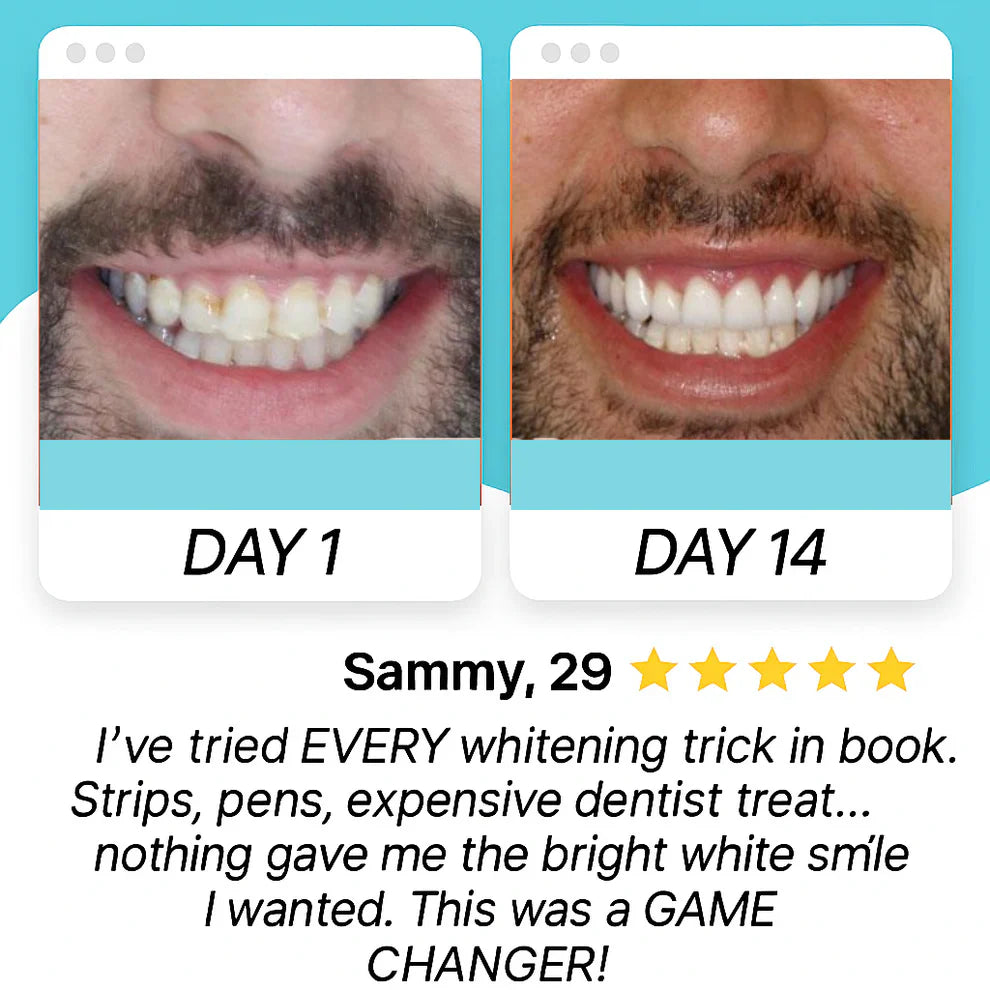 Soniflow™ – Smart Blue Light Whitening Brush